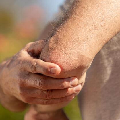 Ellenbogenschmerzen – Symptome und Auslöser